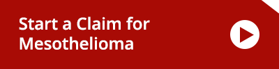 Start a claim for a Mesothelioma Start a claim for a Mesothelioma